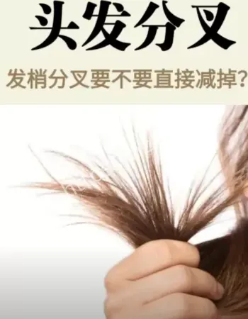 头发开叉是病